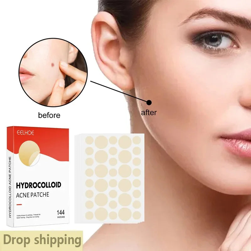 Acne Patch - Hydrocolloid Patch for Blemishes