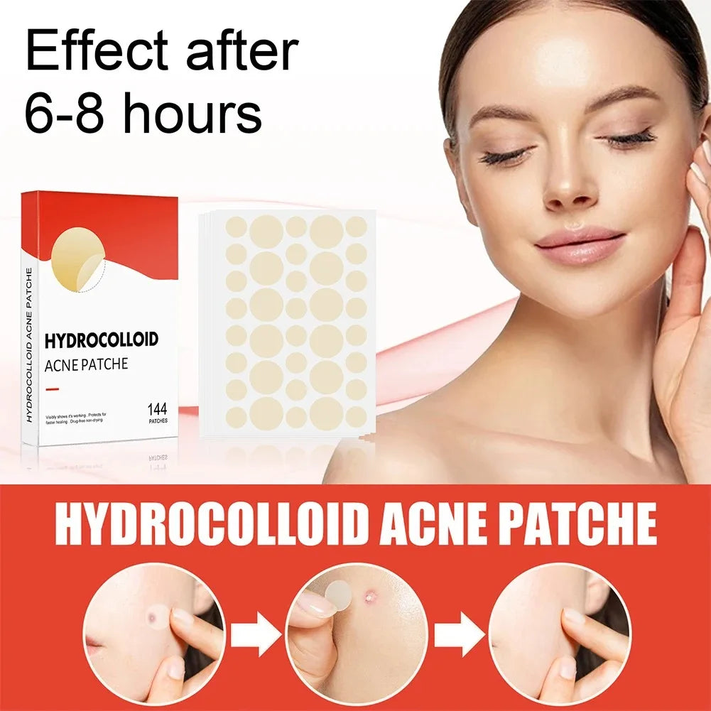 Acne Patch - Hydrocolloid Patch for Blemishes