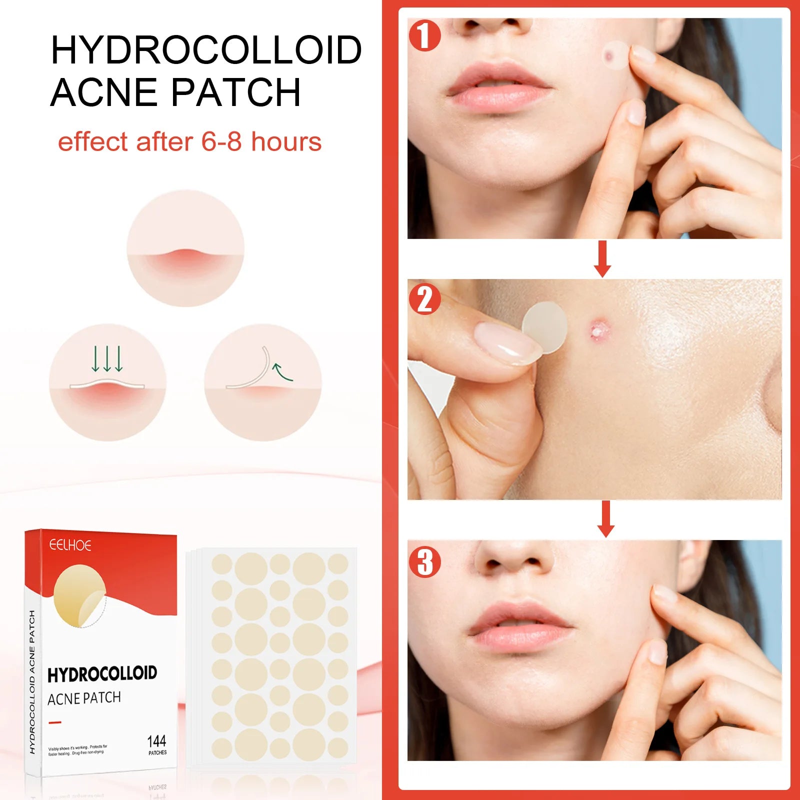 Acne Patch - Hydrocolloid Patch for Blemishes