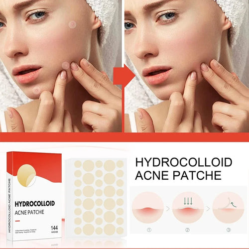 Acne Patch - Hydrocolloid Patch for Blemishes